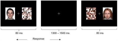 Increased Functional Connectivity During Emotional Face Processing in Children With Autism Spectrum Disorder